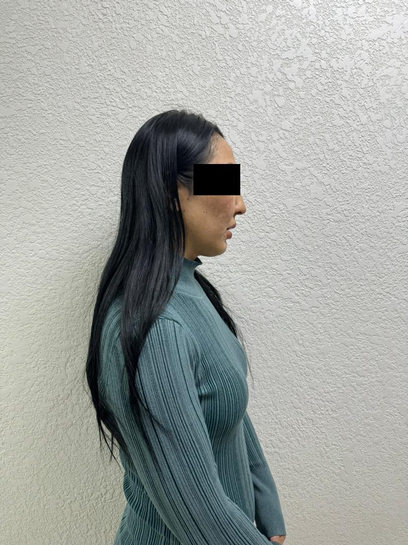 Кош бойлуу медайымга кол көтөргөн аялга кылмыш иши козголду