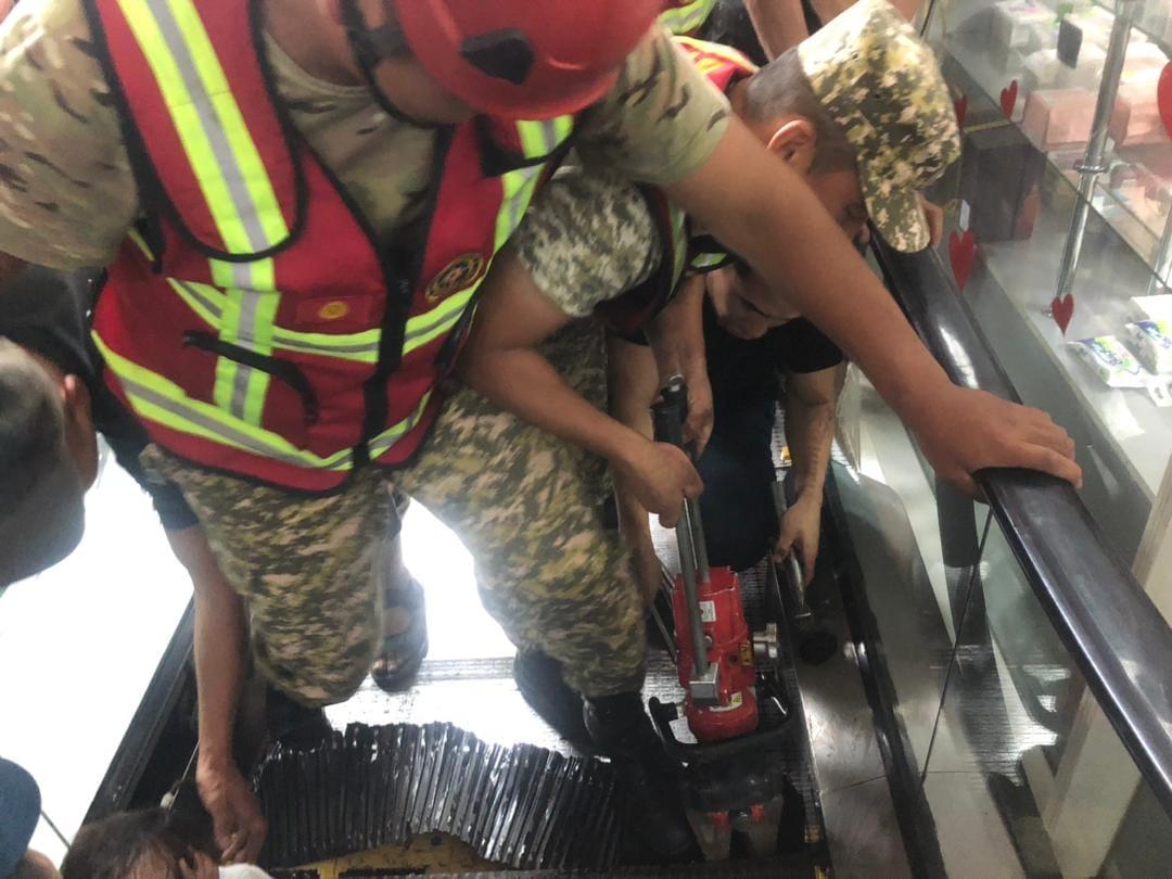 Эскалаторго буту кыпчылып калган кызга операция жасалды