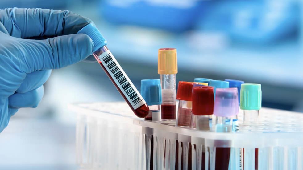 Частные лаборатории в Кыргызстане снизили цены на услуги после беседы с ГКНБ