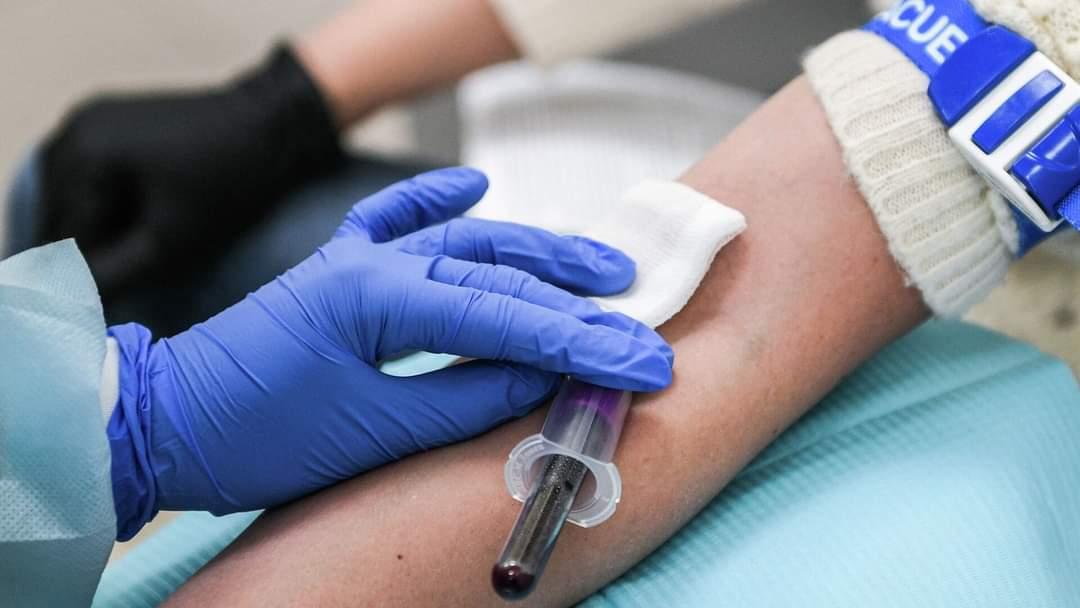 Кыргызстанда адамга күйдүргү (Сибирь жарасы) жуккан учур катталды