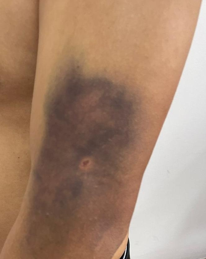 &nbsp;Камчы Көлбаевдин уюшкан кылмыштуу тобунун 29 жаштагы мүчөсү кармалды (сүрөт)