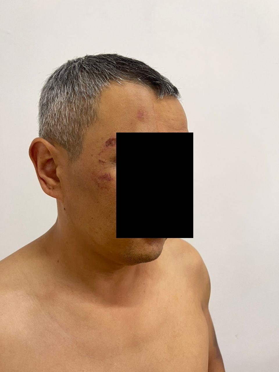 &nbsp;Камчы Көлбаевдин уюшкан кылмыштуу тобунун 29 жаштагы мүчөсү кармалды (сүрөт)